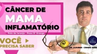 CARCINOMA-INFLAMATORIO-DE-MAMA