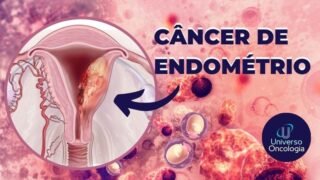 Cancer-de-Endometrio-1