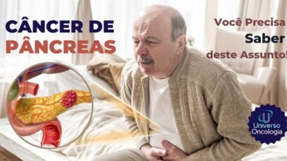 Cancer-de-Pancreas-1