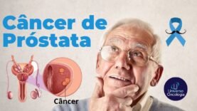 Cancer-de-prostata