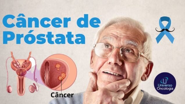 Cancer-de-prostata