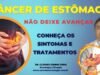 CANCER-DE-ESTOMAGO-900-×-450-px