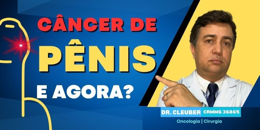 Câncer de Pênis e agora Saiba tudo Aqui Universo Oncologia