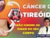 CANCER-DE-TIREOIDE-900-×-450-px