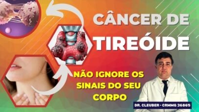 CANCER-DE-TIREOIDE-900-×-450-px