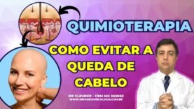 PERDA-DE-CABELO-APOS-900-×-450-px