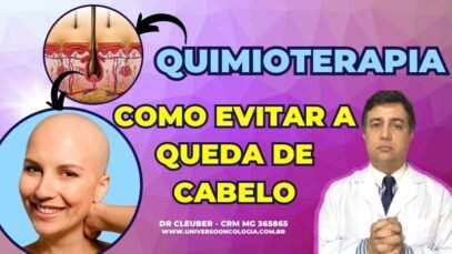 PERDA-DE-CABELO-APOS-900-×-450-px