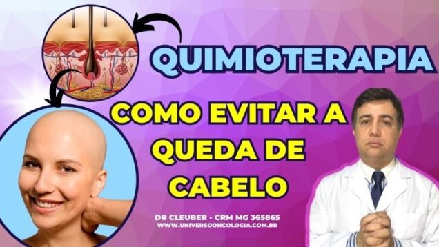 PERDA-DE-CABELO-APOS-900-×-450-px