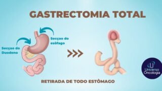 Seccao-do-Duodeno-2