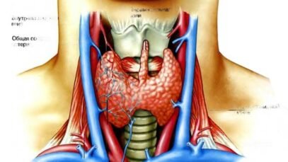 thyroid-transformed