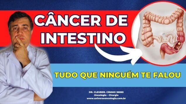 CANCER-DO-INTESTINO-GROSSO
